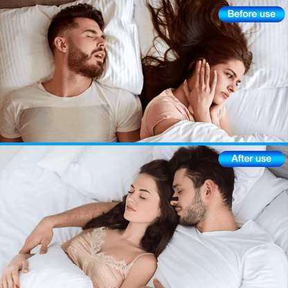 Sleep Sealed™ 150x Anti Snoring Nose Strips